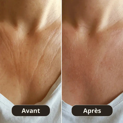 Patch Anti-Rides Décolleté Montainoir