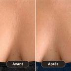 Patch Anti-Rides Décolleté Montainoir