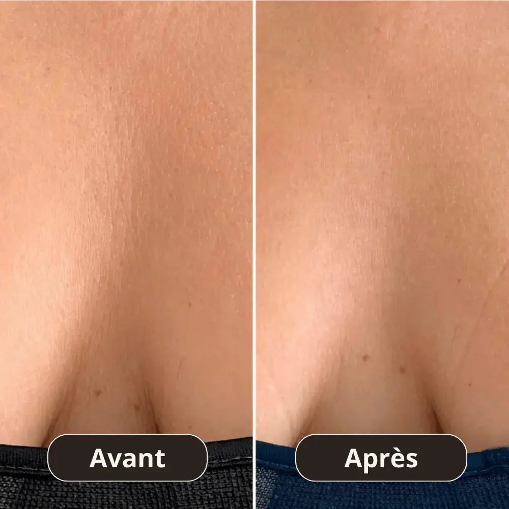 Patch Anti-Rides Décolleté Montainoir