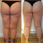 Anti-cellulite leggings - Beige